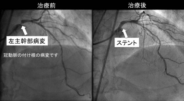 ���������²��ι�Ԥ˹Ԥ��ޤ��Τǡ�������