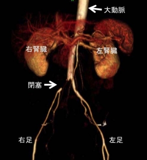 60���������100���⤯��­���ˤ��ơ�������