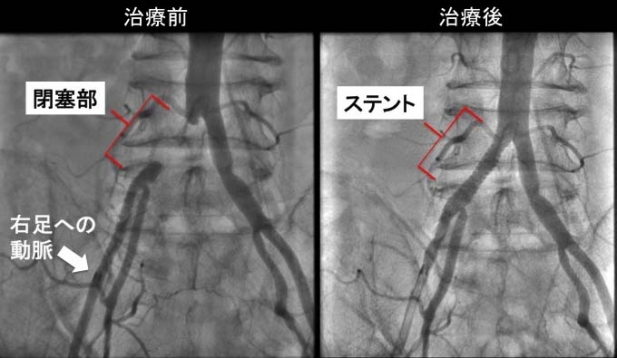 60���������100���⤯��­���ˤ��ơ�������